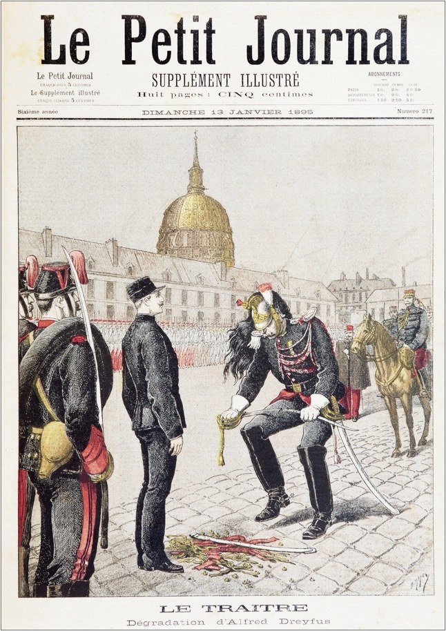 Degradación de Dreyfus