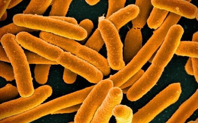 Bacterias E.-coli