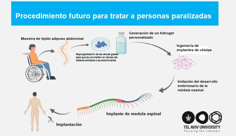 Procedimiento-personas-paralizadas tejidos